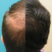 Load image into Gallery viewer, 6 Minute Laser Hair Regrowth Therapy Cap-birthday-gift-for-men-and-women-gift-feed.com
