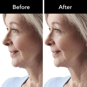Anti Wrinkle Treatment Skin Care Therapy-birthday-gift-for-men-and-women-gift-feed.com