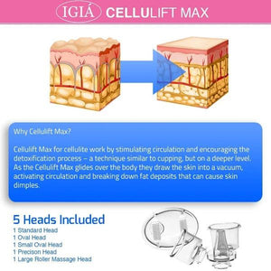Reduce Cellulite with Vacuum Cellulite Massager-birthday-gift-for-men-and-women-gift-feed.com
