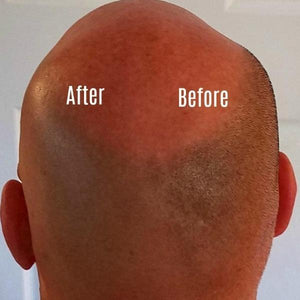 SKULLSHAVER Multifunctional Bald Head Shaver Machine-birthday-gift-for-men-and-women-gift-feed.com